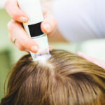 Scalp Consultation